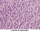controledohipocampo-1