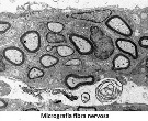 micrografiadefibranervosa-1