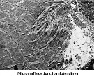 micrografiadejuncaomiotendinea-1